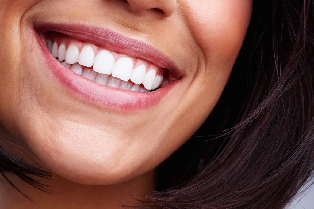 All on X Dental Implants